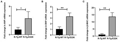 Programmed Exercise Attenuates Familial Hypertrophic Cardiomyopathy in Transgenic E22K Mice via Inhibition of PKC-α/NFAT Pathway